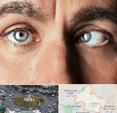 فوق تخصص استرابیسم در فردیس کرج 