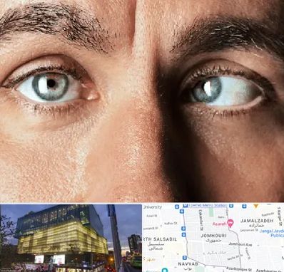 فوق تخصص استرابیسم در جمهوری 