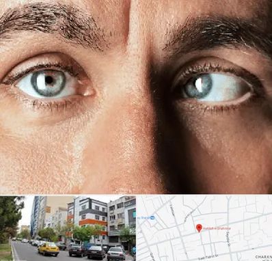 فوق تخصص استرابیسم در هفده شهریور تبریز