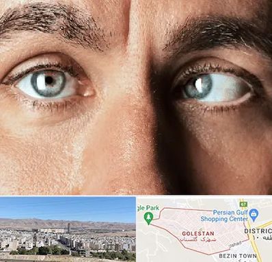 فوق تخصص استرابیسم در شهرک گلستان شیراز