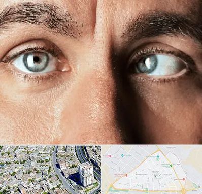 فوق تخصص استرابیسم در قاسم آباد مشهد 