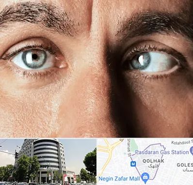 فوق تخصص استرابیسم در قلهک 