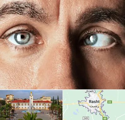 فوق تخصص استرابیسم در رشت