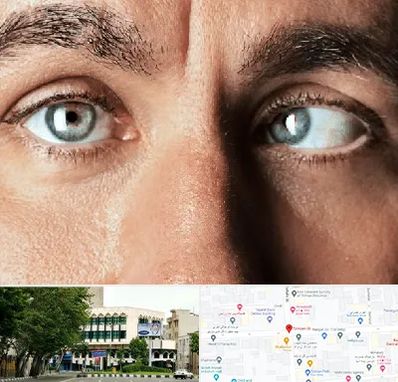 فوق تخصص استرابیسم در طالقانی 