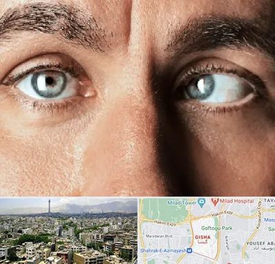 فوق تخصص استرابیسم در گیشا 