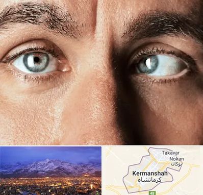 فوق تخصص استرابیسم در کرمانشاه