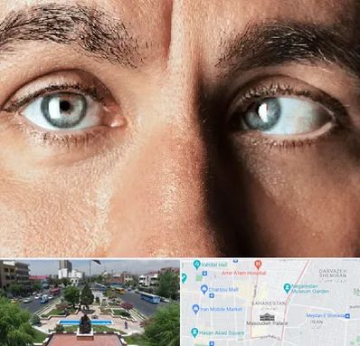 فوق تخصص استرابیسم در بهارستان 