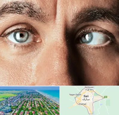 فوق تخصص استرابیسم در ساری