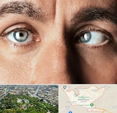 فوق تخصص استرابیسم در شهرکرد