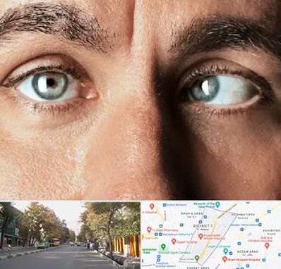 فوق تخصص استرابیسم در شریعتی 