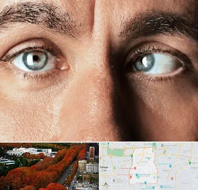 فوق تخصص استرابیسم در منطقه 6 تهران 