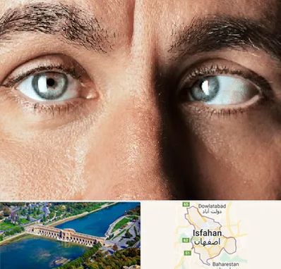 فوق تخصص استرابیسم در اصفهان