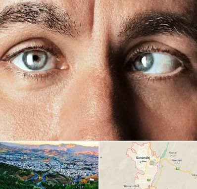 فوق تخصص استرابیسم در سنندج