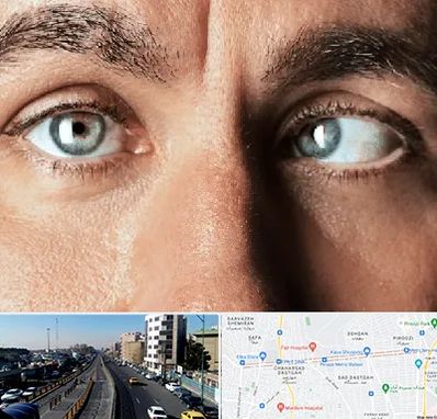 فوق تخصص استرابیسم در پیروزی 