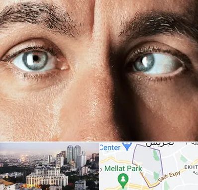 فوق تخصص استرابیسم در الهیه 