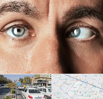 فوق تخصص استرابیسم در مفتح مشهد