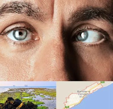 فوق تخصص استرابیسم در بندرلنگه