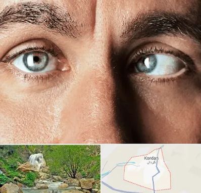 فوق تخصص استرابیسم در کردان