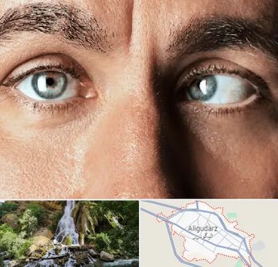 فوق تخصص استرابیسم در الیگودرز