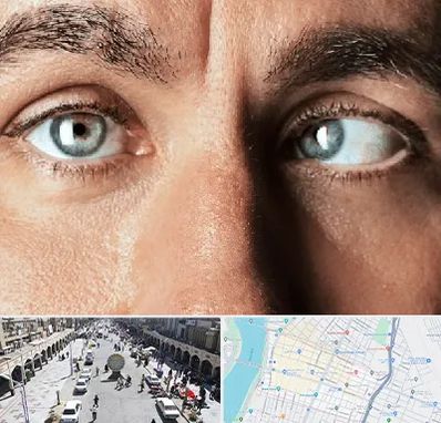 فوق تخصص استرابیسم در نادری اهواز