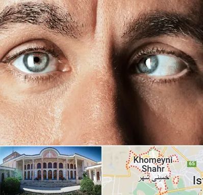 فوق تخصص استرابیسم در خمینی شهر