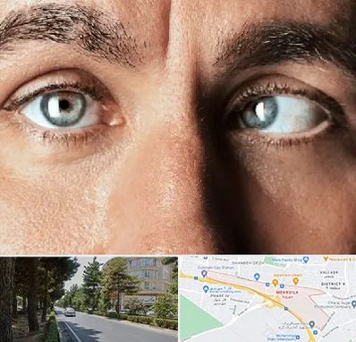 فوق تخصص استرابیسم در مهرویلا کرج