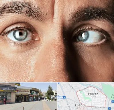 فوق تخصص استرابیسم در پرواز تبریز