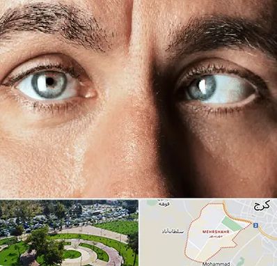 فوق تخصص استرابیسم در مهرشهر کرج 