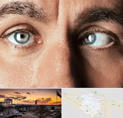 فوق تخصص استرابیسم در قوچان