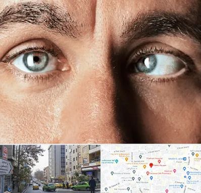 فوق تخصص استرابیسم در فاطمی 