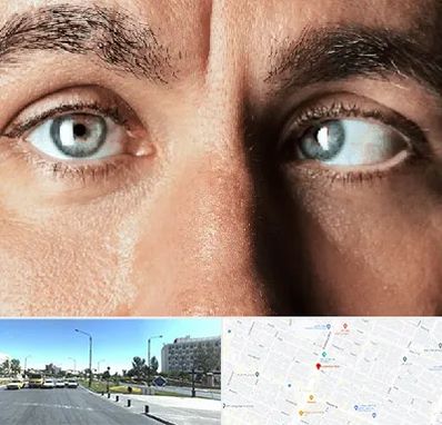 فوق تخصص استرابیسم در بلوار کلاهدوز مشهد 