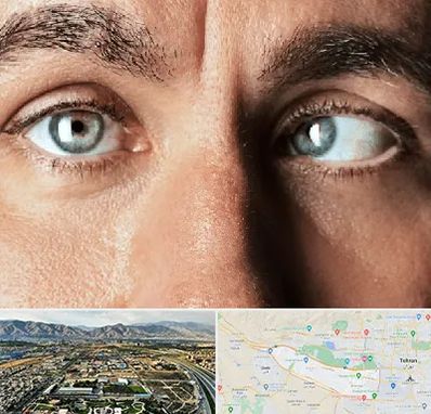 فوق تخصص استرابیسم در منطقه 21 تهران 