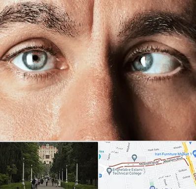 فوق تخصص استرابیسم در بلوار معلم رشت 