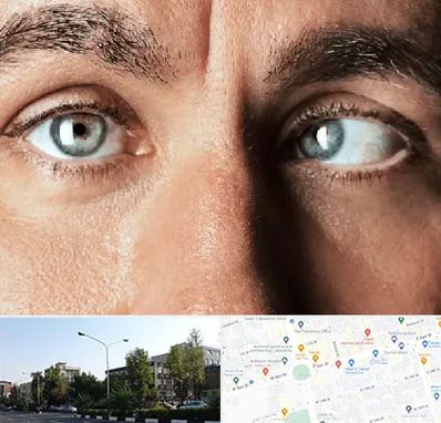 فوق تخصص استرابیسم در میدان کاج 