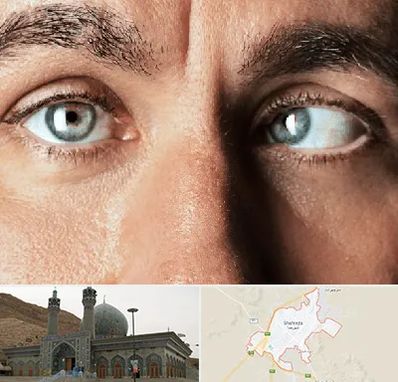 فوق تخصص استرابیسم در شهرضا