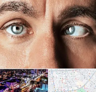 فوق تخصص استرابیسم در منظریه رشت