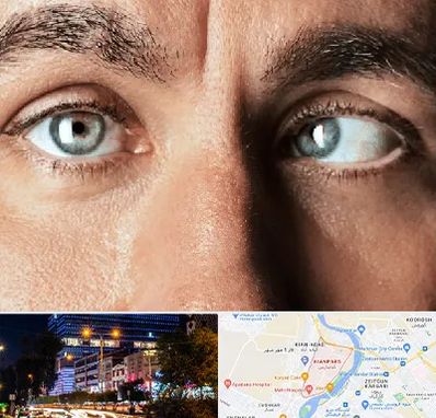 فوق تخصص استرابیسم در کیانپارس اهواز