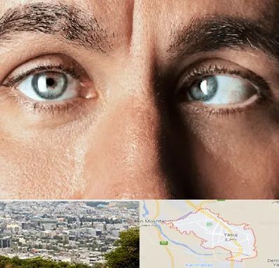 فوق تخصص استرابیسم در یاسوج