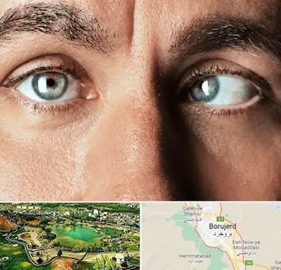 فوق تخصص استرابیسم در بروجرد