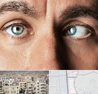 فوق تخصص استرابیسم در اسکندری