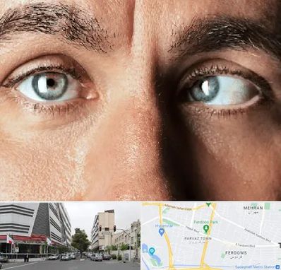 فوق تخصص استرابیسم در بلوار فردوس 