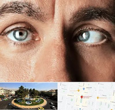 فوق تخصص استرابیسم در هفت حوض 