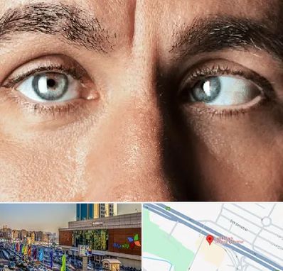 فوق تخصص استرابیسم در لاله پارک تبریز