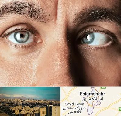 فوق تخصص استرابیسم در اسلامشهر