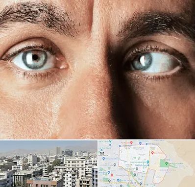 فوق تخصص استرابیسم در منطقه 14 تهران 