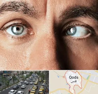 فوق تخصص استرابیسم در شهر قدس