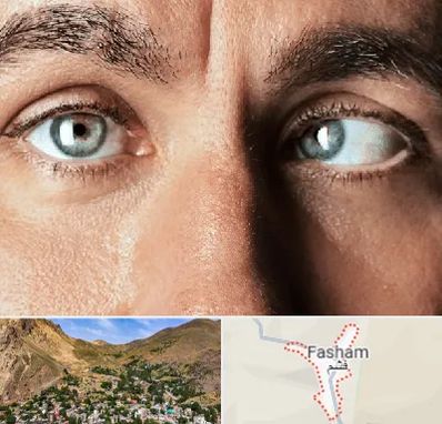 فوق تخصص استرابیسم در فشم