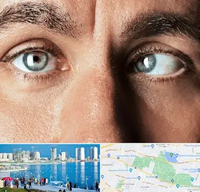 فوق تخصص استرابیسم در چیتگر 