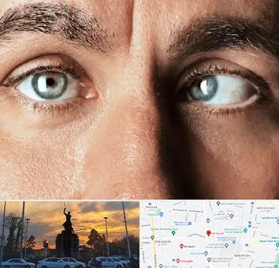 فوق تخصص استرابیسم در میدان حر 