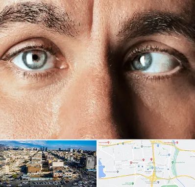 فوق تخصص استرابیسم در شهرک راه آهن